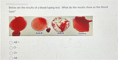 solved    results   blood typing test   cheggcom