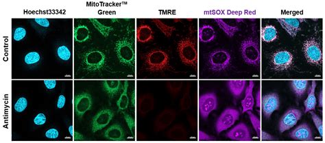 Mtsox Deep Red Mitochondrial Superoxide Detection Mt14