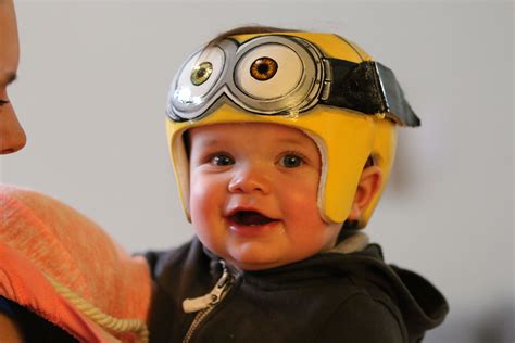 31+ Baby cranial helmet tips ideas in 2021 | knowingyourbaby