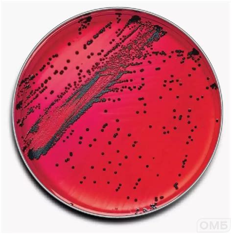 XLD aga - Агар для селективного выделения бактерий Salmonella и ...