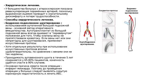 Артерии нижних конечностей - online presentation