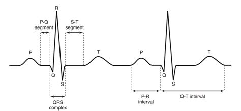 diagram  electrocardiogram ecg quizlet
