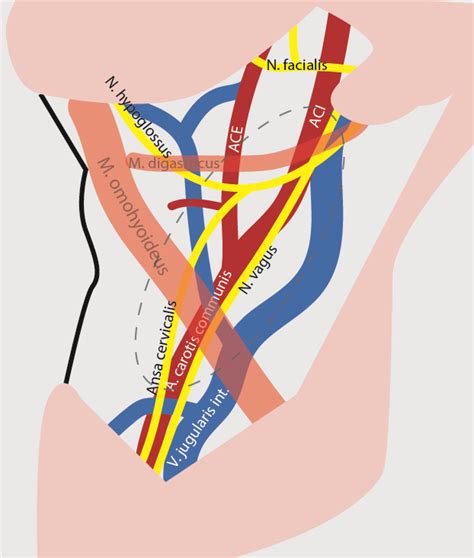 Karotisstenose Wpgefaessmanual