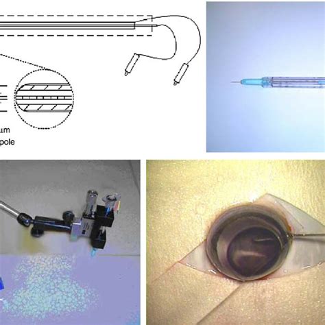electrode  positioning upper left electrode diagram  fhc