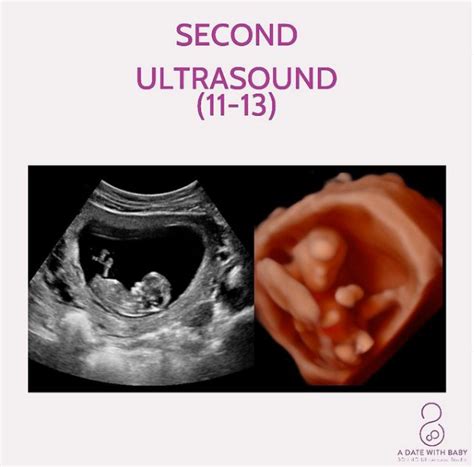 21 Weeks Pregnant Ultrasound Boy