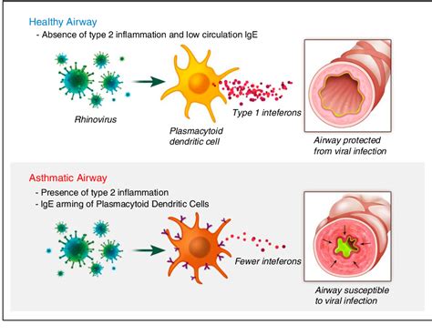 Figure 1 from The Role of Type 2 Inflammation in the Pathogenesis of ...