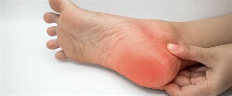 Diabetic Neuropathy Treatment Insulinic Of Florida