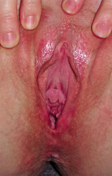 Show Me Your Vagina Xnxx Page Xnxx Adult Forum