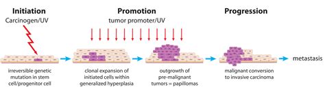 Carcinogenesis Initiation Promotion Progression
