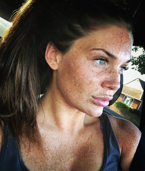 Emma Leigh Freckles Overload Porn Pic