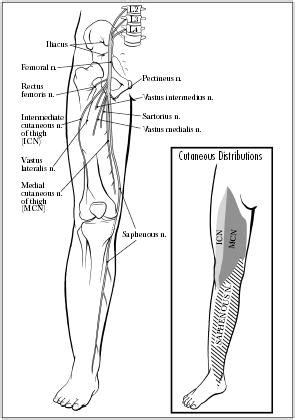 Femoral Nerve Pain: Causes & Treatment | Walk Without Pain