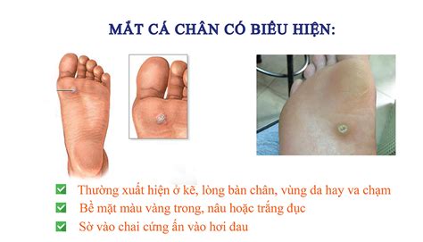 Ngứa Mắt Cá Chân Nguyên Nhân Triệu Chứng và Cách Điều Trị Hiệu Quả