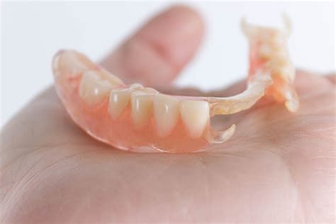 Removable Dental Bridges