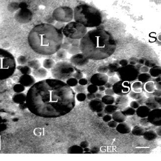 Schematic diagram of four consecutive stages of vitellogenesis in ...