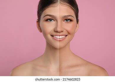 Naked Before After Images Stock Photos And Vectors Shutterstock