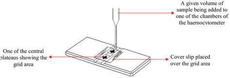 Haemocytometer Cell Count For Csf Sample 1 Microbiology Resource Hub