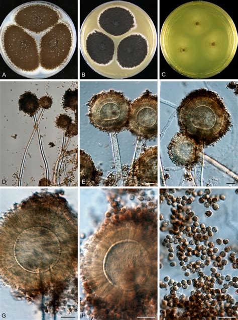 Aspergillus Eucalypticola Sp Nov AC Colonies Incubated At 25 C For