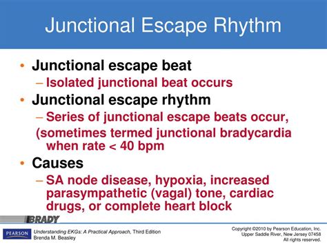 Ppt Introducing The Junctional Rhythms Powerpoint Presentation Free Download Id 6064407