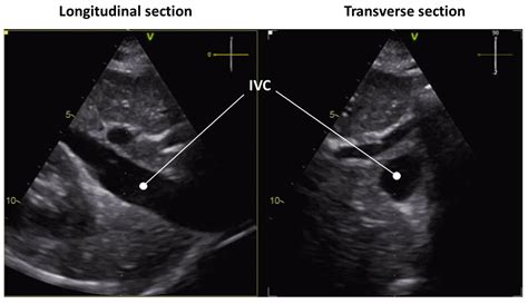 Bioengineering Free Full Text Processing Ultrasound Scans Of The