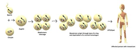 Genes Free Full Text Xy R Xy Mosaicism As A Possible