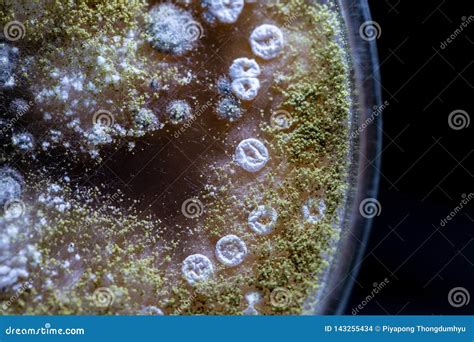 Característica De Actinomicetos De Bacterias De La Levadura Y Del