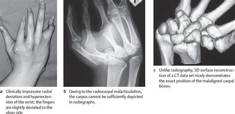 16 Malformations And Deformities Radiology Key