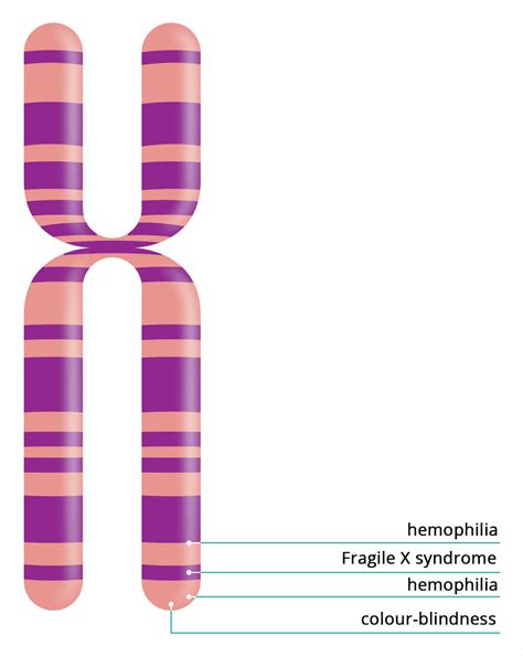 Sex Linked Traits Inheritance Of Gender Sex Traits Sex Linked Traits