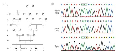 Lack Of Spartin Protein In Troyer Syndrome A Loss Of Function Disease