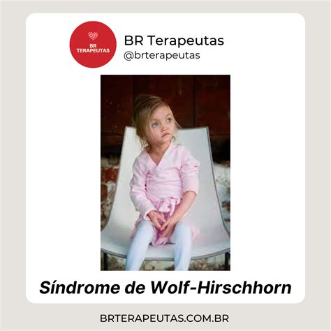 O Que é A Síndrome De Wolf Hirschhorn Causas E Sintomas Br Terapeutas