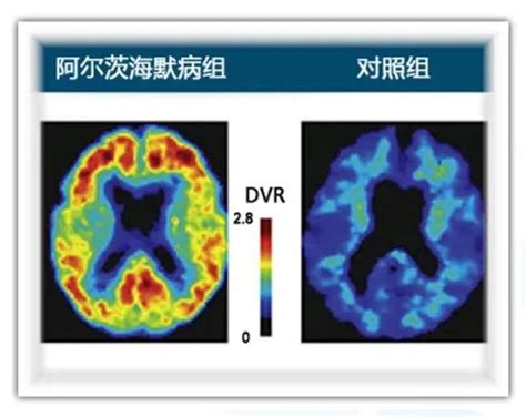 关于同位素最全的科普 中国核技术网