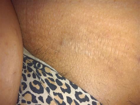 Bbw Ass Porn Pictures XXX Photos Sex Images PICTOA