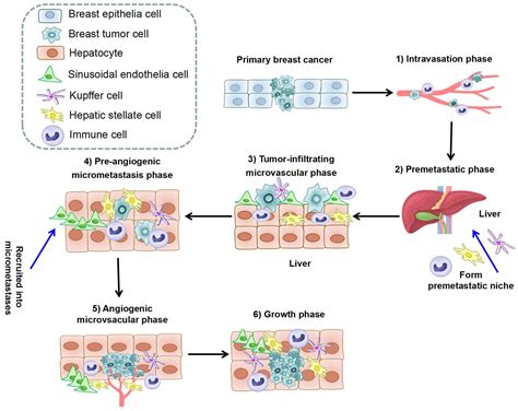 Frontiers Breast Cancer Liver Metastasis Pathogenesis And Clinical