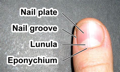 Nail Anatomy Wikidoc