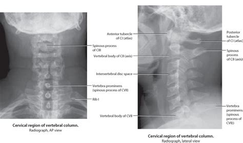 Cervical Spine X Ray Anatomy