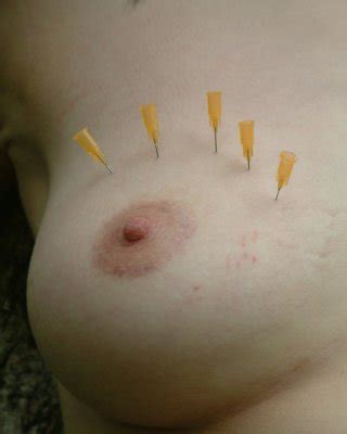 Outdoor Needle Pain And Dental Gagged Lesbian Bdsm With Slavegirl Emily Sharpe A Porn Pictures