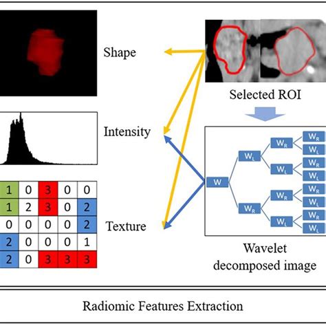 Radiomics Workflow ROI Is First Delineated Then Features Are