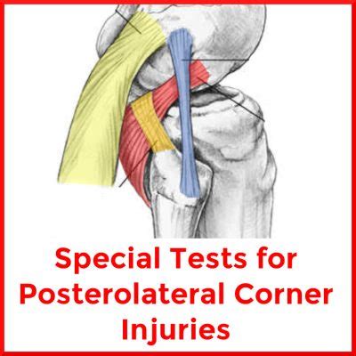 Special Tests For Posterolateral Corner Knee Injuries Sports Medicine