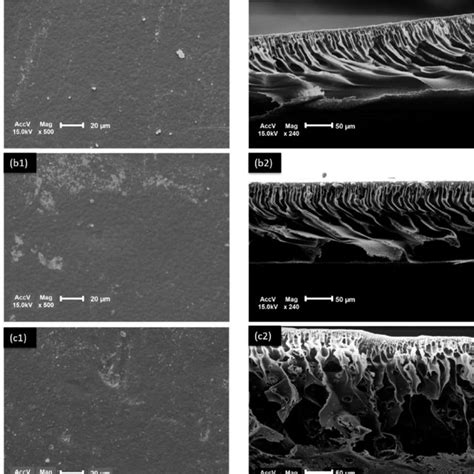 Surface Of Contact Angle Of Polyethersulfone PES Membranes With