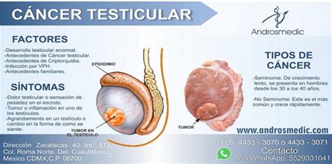 Cáncer De Testículos Síntomas Noticias Para Empresas