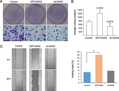 Enhanced Uv Resistance Role Of Death Domainassociated Protein In Human