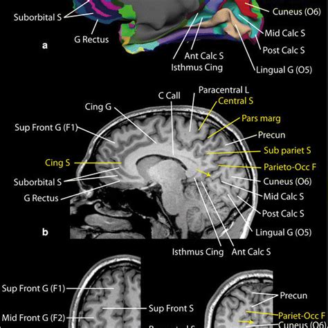 Identification Of The Sulci And Gyri Of The Frontal Lobe Lateral And