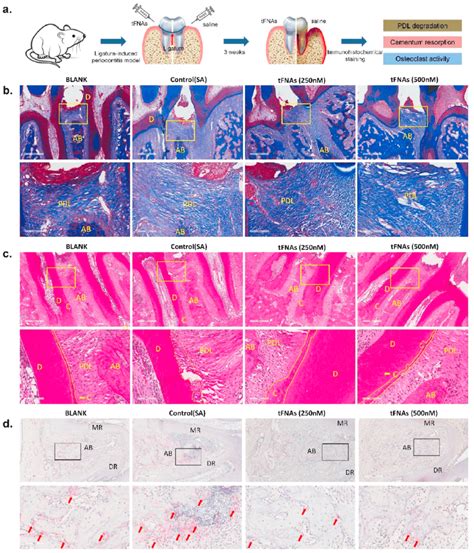 Tfnas Obviously Inhibit The Destroy Of Periodontal Tissue From