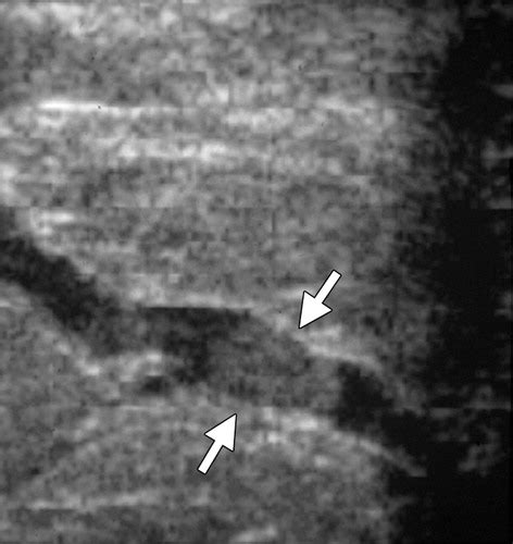 Imaging Approaches To Diagnosis And Management Of Common Ductal