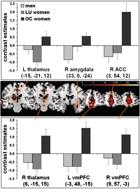 Neuronal Activation In The Extinction For The Main Effect Of Sex Download Scientific Diagram