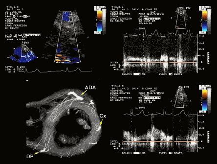 A Ecocardiografia Em Casos Especiais Parte Blog Ecope