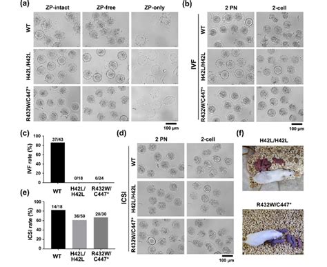 Ccin Mutations Cause Ivf Failure Which Can Be Rescued By Icsi A