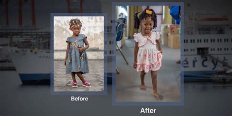mercy-ships-stories-patient-little-miracle-feature | Mercy Ships