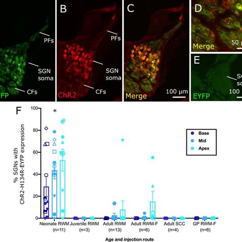 ChR2 H134R EYFP Expression In Cochlear SGNs Following RWM AAV Injection