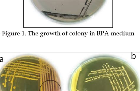 Figure From Isolation And Identification Of Biofilm Forming