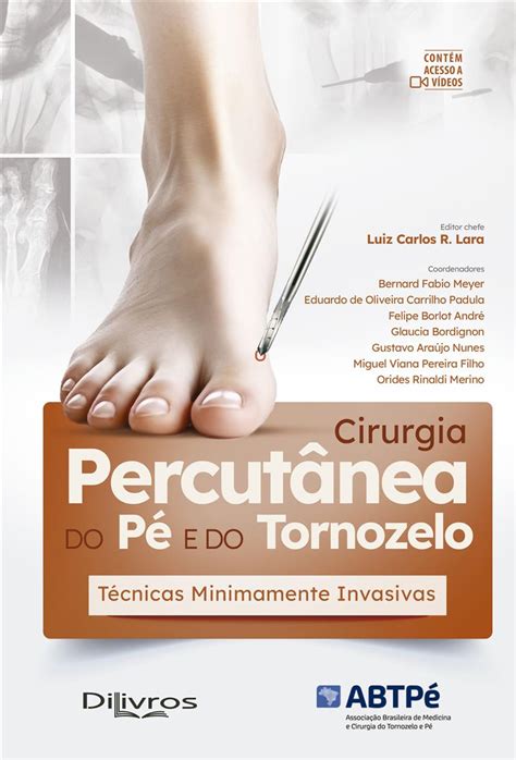 Cirurgia Percut Nea Do P E Do Tornozelo Tecnicas Minimamente Invasivas